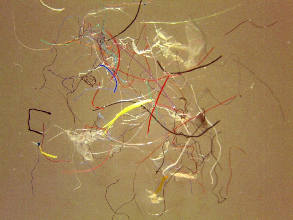 Microplastic fibers under a microscope