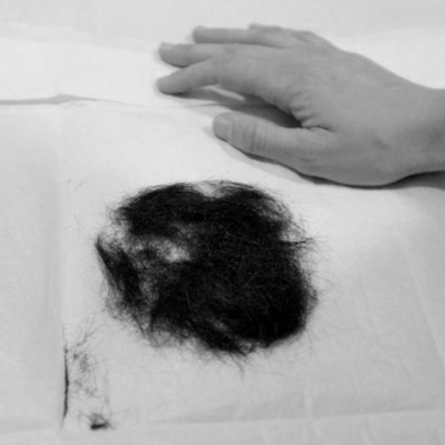 Elvis Presley’s Hair Sells at Auction